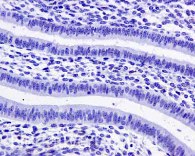 ab169788 showing -ve staining in Human normal uterus tissue.