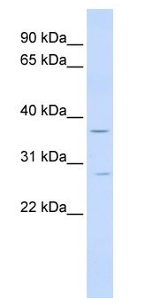 Anti-IFN gamma Receptor beta antibody (ab84524) at 1 µg/ml + Human Fetal Liver lysate at 10 µgSecondaryHRP conjugated anti-Rabbit IgG at 1: 50,000