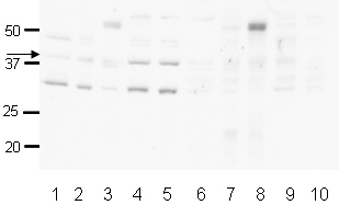 All lanes : Anti-HIF1AN antibody (ab12289) at 1/500 dilutionLane 1 : Hela nuclear extractLane 2 : Hela whole cell lysateLane 3 : A431 whole cell lysateLane 4 : Jurkat whole cell lysateLane 5 : Hek293 cell lysateLane 6 : Hela nuclear extract with FIH blocking peptide at 1 µg/mlLane 7 : Hela whole cell lysateLane 8 : A431 whole cell lysate with FIH blocking peptide at 1 µg/mlLane 9 : Jurkat whole cell lysate with FIH blocking peptide at 1 µg/mlLane 10 : Hek293 whole cell lysate with FIH blocking peptide at 1 µg/mlLysates/proteins at 20 µg per lane.SecondaryGoat polyclonal to rabbit IgG H&L (HRP) at 1/5000 dilution