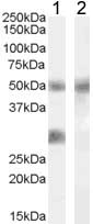 All lanes : Anti-IGFBP3 antibody (ab77635) at 0.02 µg/mlLane 1 : human breast cancer lysate (in RIPA buffer)Lane 2 : human breast cancer lysate (in RIPA buffer) with immunizing peptideLysates/proteins at 35 µg per lane.