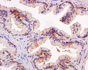Immunohistochemical analysis of paraffin-embedded Human prostate tissue labeling IGFBP7 with ab171085 at 1/50 dilution.