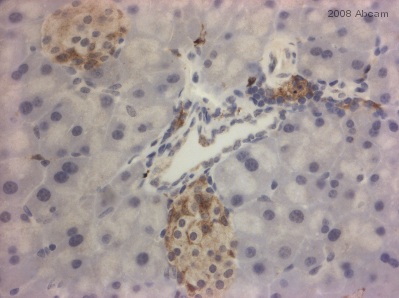ab39634 (1/50) staining Ihh in paraffin-embbeded mouse pancreas tissue sections. Tissue underwent fixation in formaldehyde, heat-mediated antigen retrieval in citrate buffer pH 6.0 and blocking (5 minutes/peroxidase block and 10 minutes/protein block). For further experimental details please refer to abreview.Strongest staining observed in islet cells of the pancreas.See Abreview