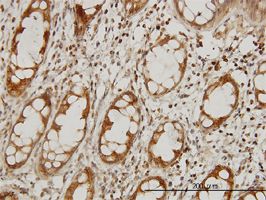 IKAP antibody (ab56362) used in immunohistochemistry at 3ug/ml on formalin fixed and paraffin embedded human colon.