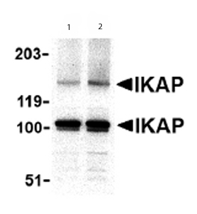 Lane 1 :  Anti-IKAP antibody - Carboxyterminal end (ab62498) at 0.5 µg/mlLane 2 :  Anti-IKAP antibody - Carboxyterminal end (ab62498) at 1 µg/mlLane 1 : A20 cell lysateLane 2 : A20 cell lysateLysates/proteins at 15 µg per lane.Secondaryanti-rabbit IgG 