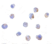 Immunocytochemistry of IKAP in A20 cells with ab62498 antibody at 1 µg/ml. 
