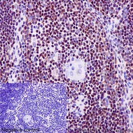 Immunohistochemical analysis of paraffin-embedded Human thymus tissue labeling Ikaros with ab191394 at 1/1400 dilution followed by pre-diluted HRP Polymer for Rabbit IgG secondary antibody and counter-stained with Hematoxylin.Inset: Negative control: using PBS instead of primary antibody.