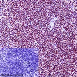 Immunohistochemical analysis of paraffin-embedded Mouse spleen tissue labeling Ikaros with ab191394 at 1/1400 dilution followed by pre-diluted HRP Polymer for Rabbit IgG secondary antibody and counter-stained with Hematoxylin.Inset: Negative control: using PBS instead of primary antibody.