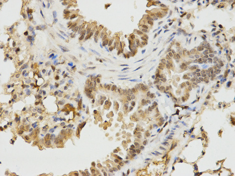Immunohistochemistry (Formalin/PFA-fixed paraffin-embedded sections) analysis of mouse lung tissue labelling Ikaros with ab180713 at 1/100. Magnification: 400x.
