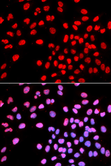 Immunocytochemistry/Immunofluorescence analysis of U2OS cells using ab180713. Blue DAPI for nuclear staining.