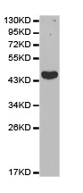 Anti-Ikaros antibody - N-terminal (ab180713) at 1/500 dilution + BT474 cell line extracts