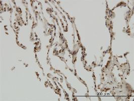 IkB beta antibody (ab58331) used in immunohistochemistry at 5ug/ml on formalin fixed and paraffin embedded human lung.