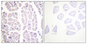 ab55341 at 1/100 staining human heart (paraffin-embedded) using IHC. Image on right is treated with the synthesized phosphopeptide and the image on the left is untreated.