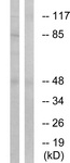 All lanes : Anti-IKK alpha + IKK beta (phospho S180 + S181) antibody (ab55341)Lane 1 : HepG2 cells treated with TNF (20 ng/ml, 5 mins)Lane 2 : HepG2 cells treated with TNF (20 ng/ml, 5 mins) with synthesized peptide