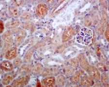 ab124957, at 1/100 dilution staining IKK beta in paraffin-embedded Mouse kidney tissue, by Immunohistochemistry.
