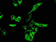 ab124957, at 1/50 dilution, staining IKK beta in HeLa cells by Immunofluorescence.