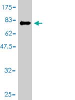 Western blot against tagged recombinant protein immunogen using ab56867 IKZF3 antibody at 1ug/ml.
