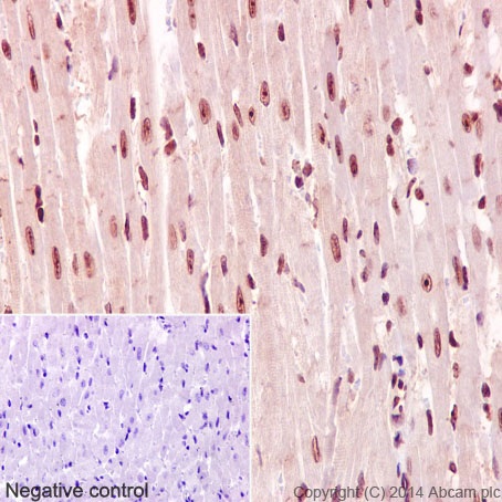 Immunohistochemistry (Formalin/PFA-fixed paraffin-embedded sections) analysis of mouse cardiac muscle tissue labelling IKZF3 with purified ab139408 at 1/100. Heat mediated antigen retrieval was performed using Tris/EDTA buffer pH 9. ab97051, a HRP-conjugated goat anti-rabbit IgG (H+L) was used as the secondary antibody (1/500). Negative control using PBS instead of primary antibody. Counterstained with hematoxylin.