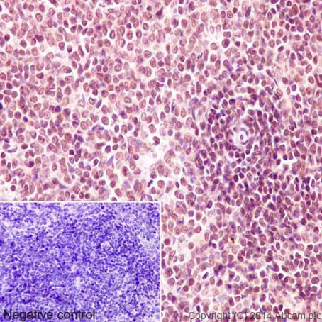 Immunohistochemistry (Formalin/PFA-fixed paraffin-embedded sections) analysis of rat spleen tissue labelling IKZF3 with purified ab139408 at 1/100. Heat mediated antigen retrieval was performed using Tris/EDTA buffer pH 9. ab97051, a HRP-conjugated goat anti-rabbit IgG (H+L) was used as the secondary antibody (1/500). Negative control using PBS instead of primary antibody. Counterstained with hematoxylin.