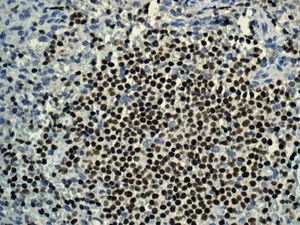 Immunohistochemistry (Formalin/PFA-fixed paraffin-embedded sections) analysis of human spleen tissue labelling IKZF3 with unpurified ab139408 at 1/250 dilution.