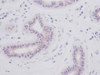 ab9614 at 1.0 µg/ml staining normal human skin by IHC-P. The antibody was incubated overnight at 4°C. An HRP-labeled polymer detection system was used with a non-alcohol soluble AEC chromogen. Enzyme induced antigen retrieval was performed with proteinase K.