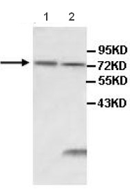 All lanes : Anti-IL1 Receptor I antibody (ab106278) at 1/500 dilutionLane 1 : Human fetal spleen lysateLane 2 : HeLa cell lysate