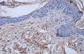 ab106278, at 1/100 dilution, staining IL1 Receptor 1 in Formalin-fixed, paraffin-embedded Human fetal skin sections by immunohistochemistry.