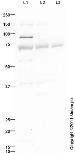 All lanes : Anti-IL1 Receptor I antibody (ab94393) at 1 µg/mlLane 1 : Heart (Human) Tissue Lysate - adult normal tissue (ab29431)Lane 2 : Placenta (Human) Tissue Lysate - adult normal tissue (ab29745)Lane 3 : Lung (Human) Tissue LysateLysates/proteins at 10 µg per lane.SecondaryGoat Anti-Rabbit IgG H&L (HRP) preadsorbed (ab97080) at 1/5000 dilutiondeveloped using the ECL techniquePerformed under reducing conditions.