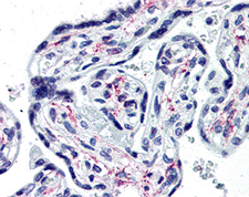 ab115497, at 10 &microg/ml, staining IL1 Receptor I in formalin-fixed, paraffin-embedded Human Placenta tissue by Immunohistochemistry using a biotinylated anti-mouse IgG secondary antibody, alkaline phosphatase-streptavidin and chromogen.