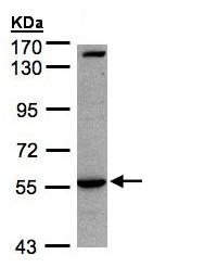 Anti-IL1 Receptor I antibody - C-terminal (ab154524) at 1/1000 dilution + Raji whole cell lysate at 30 µg