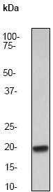 Anti-IL10 antibody [EP1115Y] (ab52909) at 1/5000 dilution + Recombinant protein (5ng)SecondaryGoat anti-Rabbit HRP labeled at 1/2000 dilution