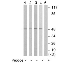 All lanes : Anti-IL13 receptor alpha 1 antibody (ab79277) at 1/500 dilutionLane 1 : COLO cell extractsLane 2 : HT29 cell extractsLane 3 : A549 cell extractsLane 4 : 293 cell extractsLane 5 : COLO cell extracts with immunising peptide at 10 µgLysates/proteins at 30 µg per lane.