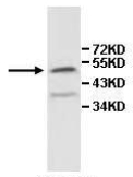 Anti-IL13 receptor alpha 1 antibody (ab108499) at 1/500 dilution + A549 cell lysate
