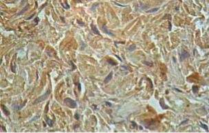 1/100 ab108499 staining IL13 receptor alpha 1 in formalin-fixed, paraffin-embedded Human fetal heart tissue.