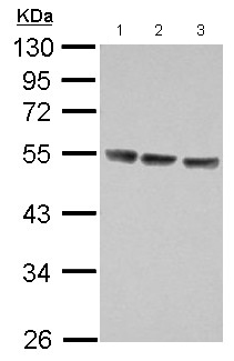All lanes : Anti-IL13 receptor alpha 1 antibody (ab154380) at 1/5000 dilutionLane 1 : Jurkat whole cell lysateLane 2 : Raji whole cell lysateLane 3 : K562 whole cell lysateLysates/proteins at 30 µg per lane.