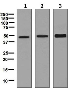 All lanes : Anti-IL13 receptor alpha 1 antibody [EPR5447(2)] (ab129188) at 1/1000 dilutionLane 1 : HT-29 cell lysatesLane 2 : A549 cell lysatesLane 3 : SK-OV-3 cell lysatesLysates/proteins at 10 µg per lane.SecondaryHRP labelled goat anti-rabbit at 1/2000 dilution
