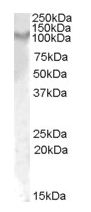 Anti-IL17A Receptor antibody (ab133416) at 1 µg/ml + Rat Kidney lysate (in RIPA buffer) at 35 µgdeveloped using the ECL technique