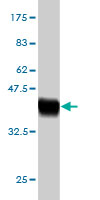Western blot against tagged recombinant protein immunogen using ab57196 IL17B antibody at 1ug/ml.