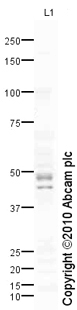 Anti-IL17B Receptor antibody (ab77524) at 1 µg/ml + Liver (Human) Tissue Lysate - adult normal tissue (ab29889) at 10 µgSecondaryGoat polyclonal to Rabbit IgG - H&L - Pre-Adsorbed (HRP) at 1/3000 dilutiondeveloped using the ECL techniquePerformed under reducing conditions.