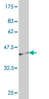 Western blot against tagged recombinant protein immunogen using ab57998 IL18R Beta antibody at 1ug/ml.