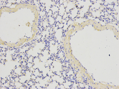 Immunohistochemistry (Formalin/PFA-fixed paraffin-embedded sections) analysis of mouse lung tissue labelling IL1RA with ab175392 at 1/200. Magnification: 200x.