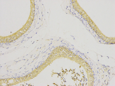 Immunohistochemistry (Formalin/PFA-fixed paraffin-embedded sections) analysis of human epididymis tissue labelling IL1RA with ab175392 at 1/200. Magnification: 200x.