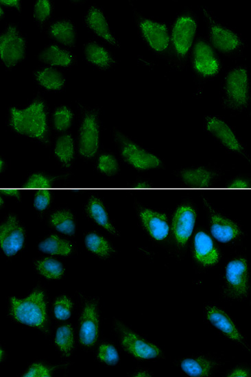 Immunocytochemistry/Immunofluorescence analysis of MCF7 cells using ab175392. Blue DAPI for nuclear staining.