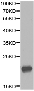 Anti-IL1RA antibody (ab175392) at 1/500 dilution + 293 cell extract