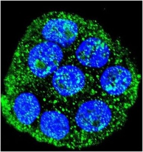 Confocal immunofluorescent analysis of ab135570 at 1/10 dilution with WiDr cell followed by Alexa Fluor 488-conjugated goat anti-rabbit lgG (green). DAPI was used to stain the cell nuclear (blue).