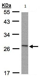 Anti-IL1RA antibody (ab97301) at 1/1000 dilution + Molt-4 whole cell lysate at 30 µg
