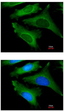Immunofluorescence analysis of methanol-fixed HeLa, using ab97301 at 1/200 dilution. Lower image costained with Hoechst 33342.