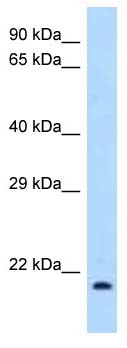 Anti-IL1RA antibody (ab123235) at 1 µg/ml + 293T cell lysate at 10 µgSecondaryGoat anti-Rabbit IgG HRP