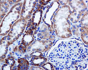 ab124962, at a 1/100 dilution, staining IL1RA in paraffin embedded Human kidney tissue by Immunohistochemistry.