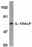 Anti-IL1RAP antibody (ab8110) at 1/1000 dilution + HeLa whole cell lysateObserved band size : 66 kDa (why is the actual band size different from the predicted?)