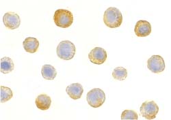 ab8109 at 5µg/ml staining IL1RAP in Hela cells by ICC/IF